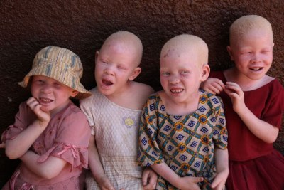 Albinos.