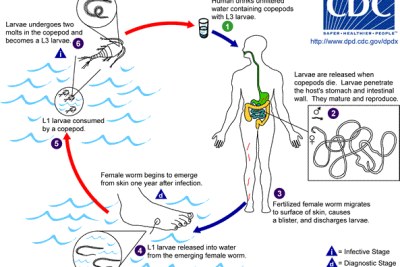 Diagram of the life cycle of Dracunculus medinensis (Guinea worm).