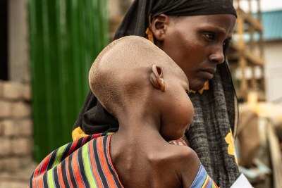 Une mère et son enfant dénutri à Dollow, en Somalie