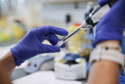 Testing for Mpox.